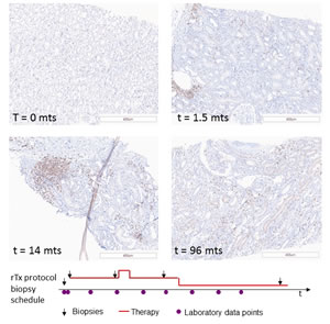 Example for consecutive, so-called 'protocol biopsies'