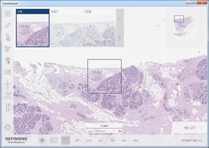Definiens TissueExplorer™ software