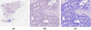 Identification of cell nuclei in an H&E-stained breast-tissue sample